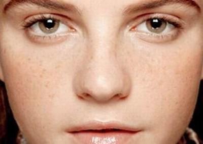 銀川點(diǎn)陣激光磨削痘坑一次需要價(jià)格是多少錢啊(銀川軍大美容中心點(diǎn)陣激光磨削痘坑參考價(jià)：6896元)