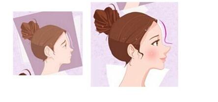 漢中魔法肉毒素注射費(fèi)用明細(xì)查詢(2023漢中魔法肉毒素注射參考價(jià)為：5913元)