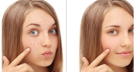 大連小切口拉皮手術(shù)價(jià)格表2023全新來(lái)襲(2023大連小切口拉皮手術(shù)參考價(jià)為：6174元)