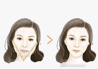 石家莊乳房重建價(jià)格