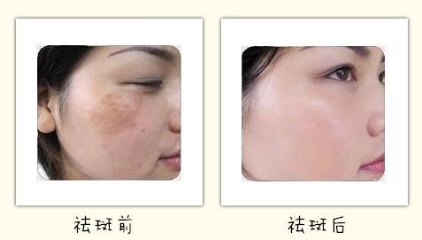 龍巖韓式立體紋繡最新價(jià)格(2023龍巖韓式立體紋繡參考價(jià)為：7518元)