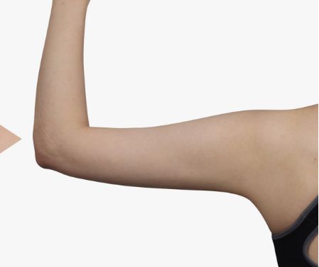 大連按摩治療脫發(fā)治療價(jià)格信息公布(2023大連按摩治療脫發(fā)參考價(jià)為：6888元)