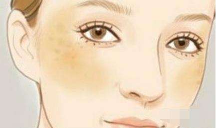 邢臺(tái)去淺皺紋一次一般要花費(fèi)多少錢(2023邢臺(tái)去淺皺紋參考價(jià)為：6441元)