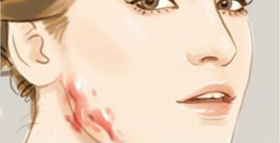 長沙乳頭縮小術(shù)通常要多少錢(2023長沙乳頭縮小術(shù)參考價(jià)為：6386元)