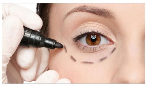 烏魯木齊電波拉皮祛除的費(fèi)用多少錢明細(xì)清單一覽(2023烏魯木齊電波拉皮祛除參考價為：5443元)