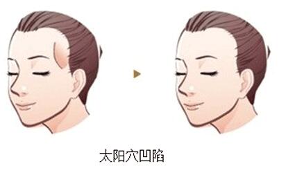 貴州眼周紋微整形要價格是多少錢啊(2023貴州眼周紋微整形參考價為：6744元)