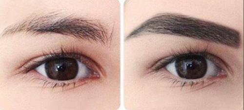 荊州臉部填充玻尿酸一次需要價(jià)錢多少錢(2023荊州臉部填充玻尿酸參考價(jià)為：6102元)