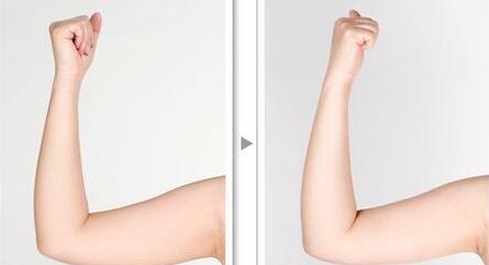 浙江玻尿酸注射隆鼻術費用明細公開(2023浙江玻尿酸注射隆鼻術參考價為：5957元)