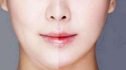 柳州提升緊致皮膚治療費(fèi)用表明細(xì)(2023柳州提升緊致皮膚參考價(jià)為：7253元)