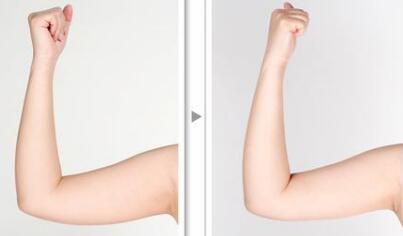 貴陽電波拉皮祛除頸紋報價一般花多少錢(2023貴陽電波拉皮祛除頸紋參考價為：5262元)