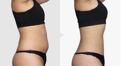 昆明頸部皺紋打玻尿酸手術(shù)費(fèi)用表剖析(2023昆明頸部皺紋打玻尿酸參考價(jià)為：5328元)