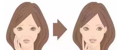 陜西嗨體額部注射費(fèi)用多少錢左右(2023陜西嗨體額部注射參考價(jià)為：5282元)