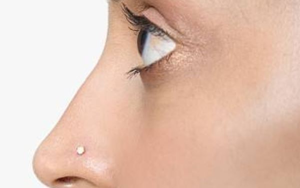 上海打針去魚尾紋價(jià)格你知道嗎(2023上海打針去魚尾紋參考價(jià)為：6953元)