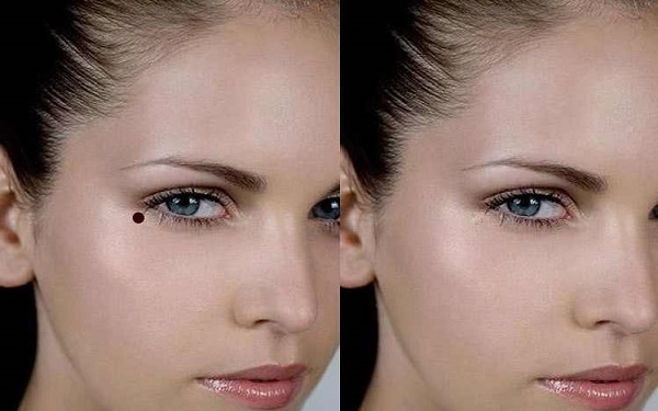 天津美膚祛斑價(jià)格均價(jià)(2023天津美膚祛斑參考價(jià)為：6027元)