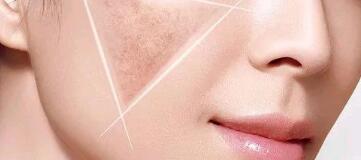 上海眼部皺紋整形大概費(fèi)用是多少呢(2023上海眼部皺紋整形參考價(jià)為：5084元)