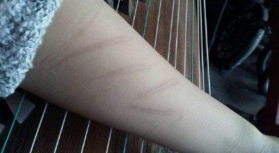 西安抽肚子脂肪填充胸部?jī)r(jià)格