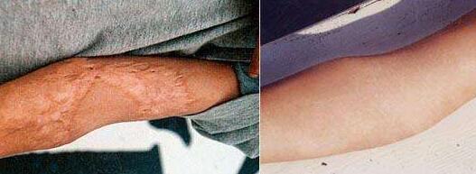 上海消除眼底紋術(shù)收費(fèi)標(biāo)準(zhǔn)2023詳細(xì)展示(2023上海消除眼底紋術(shù)參考價(jià)為：7062元)