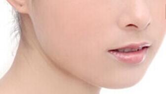 鄭州鼻翼溝整形治療價目表曝光(2023鄭州鼻翼溝整形參考價為：7599元)