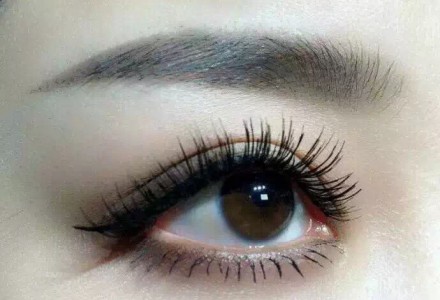 重慶射頻激光祛黃褐斑價格