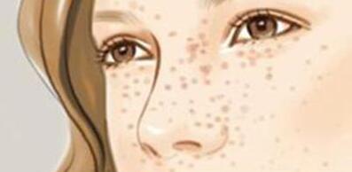 臺州豐耳垂術(shù)報價手術(shù)價錢(2023臺州豐耳垂術(shù)參考價為：6670元)