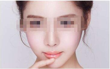 濟南玻尿酸生長紋填充價目表是多少錢(山東省濟南醫(yī)院整形科玻尿酸生長紋填充參考價：3743元)