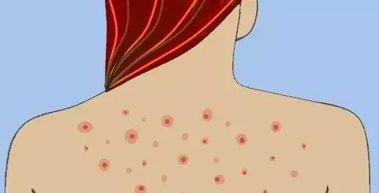 長沙鼻唇溝填充美容術(shù)大致能夠花多少錢(長沙第一醫(yī)院醫(yī)學(xué)美容中心鼻唇溝填充美容術(shù)參考價(jià)：4223元)