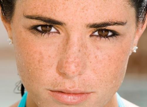 南通深藍熱塑射頻除皺大致可以花費多少費用(南通伯思立醫(yī)學(xué)美容醫(yī)院深藍熱塑射頻除皺參考價：6264元)