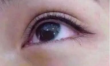 蘇州膠原蛋白填充眼窩治療價目表公示(蘇州姑蘇區(qū)醫(yī)顏醫(yī)療美容診所膠原蛋白填充眼窩參考價：5629元)