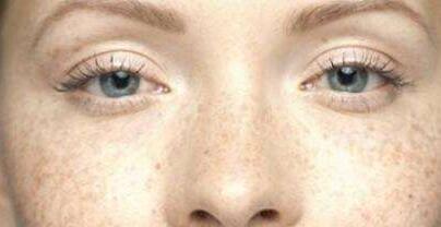 德陽線雕祛除眼底紋價格信息公布(德陽瑪麗婦科醫(yī)院線雕祛除眼底紋參考價：5279元)