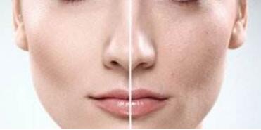 蕭山無(wú)創(chuàng)瘦臉價(jià)格要好多(杭州蕭山韓藝醫(yī)療美容醫(yī)院無(wú)創(chuàng)瘦臉參考價(jià)：4791元)