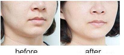 南京激光祛除老年斑價格構(gòu)成要素有哪些(南京靈芝源美容中心醫(yī)療美容診所激光祛除老年斑參考價：5744元)