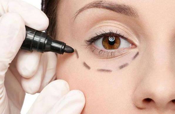 深圳皮秒激光祛除眼周細(xì)紋價格表2023在線公布(深圳藝星醫(yī)療美容醫(yī)院皮秒激光祛除眼周細(xì)紋參考價：5665元)