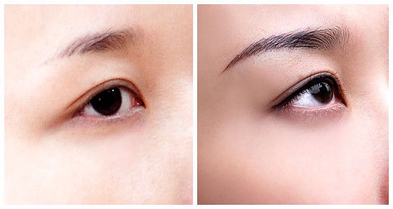 北京6S急速溶脂瘦身價格表收費目錄一覽(北京京韓整形醫(yī)院6S急速溶脂瘦身參考價：6543元)