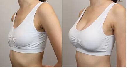 昆明微創(chuàng)眼部除皺手術(shù)2023價(jià)格表在線預(yù)覽(昆明醫(yī)科大學(xué)第一附屬醫(yī)院微創(chuàng)眼部除皺手術(shù)參考價(jià)：3135元)