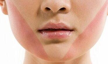 西安自體脂肪豐臥蠶整形一次大概要多少錢(qián)(西安現(xiàn)代醫(yī)療美容整形醫(yī)院自體脂肪豐臥蠶整形參考價(jià)：4484元)