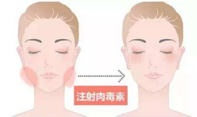 鄭州自體填充靜態(tài)紋費(fèi)用2023在線公布(鄭州第一醫(yī)院自體填充靜態(tài)紋參考價(jià)：4581元)