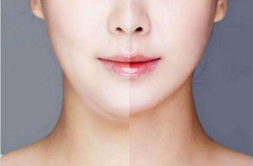 益陽耳軟骨鼻整形費(fèi)用查詢(益陽第五人民醫(yī)院整形科耳軟骨鼻整形參考價(jià)：3359元)