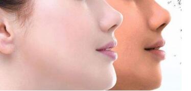 佛山色斑綜合治療價格詳情一覽(佛山君美醫(yī)療美容醫(yī)院色斑綜合治療參考價：6930元)