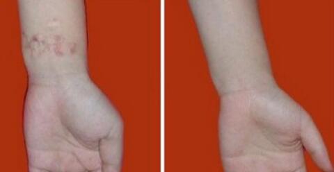 北京女性私密價(jià)目表全新參考(北京圣嘉榮醫(yī)療美容醫(yī)院女性私密參考價(jià)：4903元)