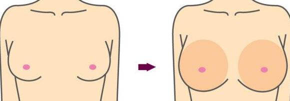 昆明光子去除老年斑價格2023明細上線(昆明前衛(wèi)美眼醫(yī)療美容診所光子去除老年斑參考價：3739元)