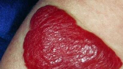 九江面部整形美容價(jià)格表一覽搶先看(九江附屬醫(yī)院面部整形美容參考價(jià)：3541元)