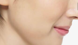 寧夏負(fù)壓去黑頭手術(shù)價(jià)格表出爐(寧夏崔大夫博士麗醫(yī)療美容門診部負(fù)壓去黑頭參考價(jià)：6628元)