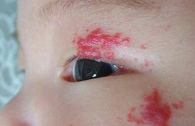 成都腰腹大腿抽脂大概要治療費用多少(成都俏可麗醫(yī)療美容腰腹大腿抽脂參考價：6400元)