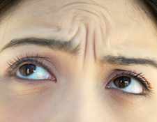 廊坊MISKO4D隆鼻價格