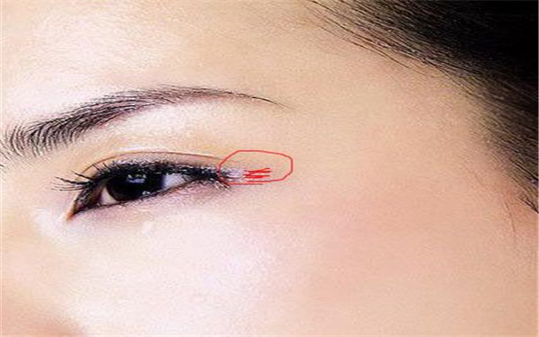 青海墊下巴美容一次通常要花費多少錢(青海大學(xué)附屬醫(yī)院墊下巴美容參考價：3098元)