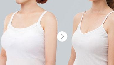 重慶點(diǎn)陣激光去疤收費(fèi)價(jià)格表2023剖析(重慶銅梁區(qū)人民醫(yī)院點(diǎn)陣激光去疤參考價(jià)：5440元)