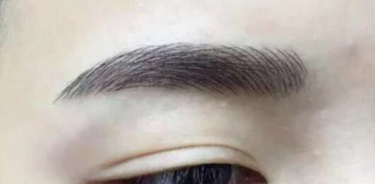 洛陽自身脂肪豐唇需要用多少錢(洛陽第三人民醫(yī)院整形外科自身脂肪豐唇參考價(jià)：6063元)