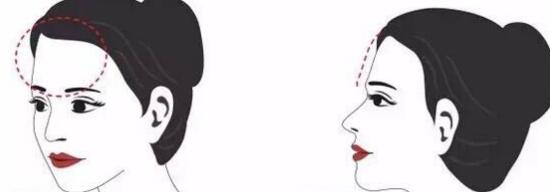 廣州精雕祛魚尾紋價格表2023版上線(廣州HJR韓佳人網(wǎng)紅整形美容門診部精雕祛魚尾紋參考價：5106元)