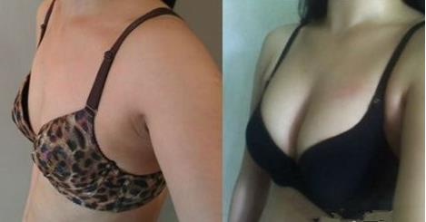 鄭州微創(chuàng)溶脂去眼袋治療價(jià)格表標(biāo)準(zhǔn)明細(xì)對(duì)比(鄭州七妍琳醫(yī)療美容醫(yī)院微創(chuàng)溶脂去眼袋參考價(jià)：5571元)