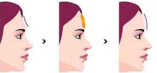 蕪湖注射肉毒素去狐臭2023費(fèi)用全新上線(安徽蕪湖瑞麗整形美容醫(yī)院注射肉毒素去狐臭參考價：3965元)